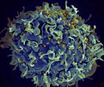 Identifica CDC los primeros casos documentados de VIH